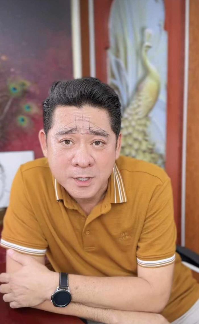 Diễn viên Huỳnh Anh Tuấn U60 công khai 'tân trang' vẻ ngoài, kết quả ra sao so với MC Thanh Bạch? Ảnh 1